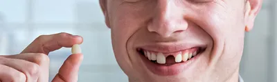 Десна и зубы человека нижней челюсти. Медицинская точная 3D иллюстрация зуба