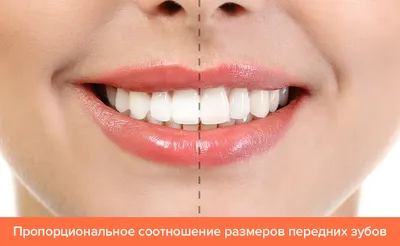 ᐉ Какого размера должны быть зубы ⏩⏩⏩ Норма и отклонение