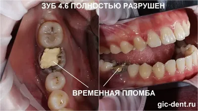 Почему нужно регулярно приводить ребенка к детскому стоматологу | Детская и  семейная стоматологическая клиника \"Белая Медведица\" | Санкт-Петербург