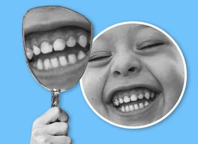 Когда выпадают молочные зубы - Стоматологическая клиника доктора Лапченко -  Блог