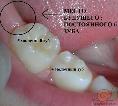 6 зуб у ребенка - BabyDentist