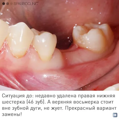 Связь зубов с организмом