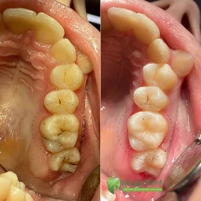 Зубы человека — анатомия, строение и виды зубов