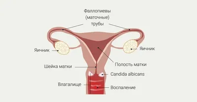 Причины и методы лечения зуда в паховой области и во влагалище